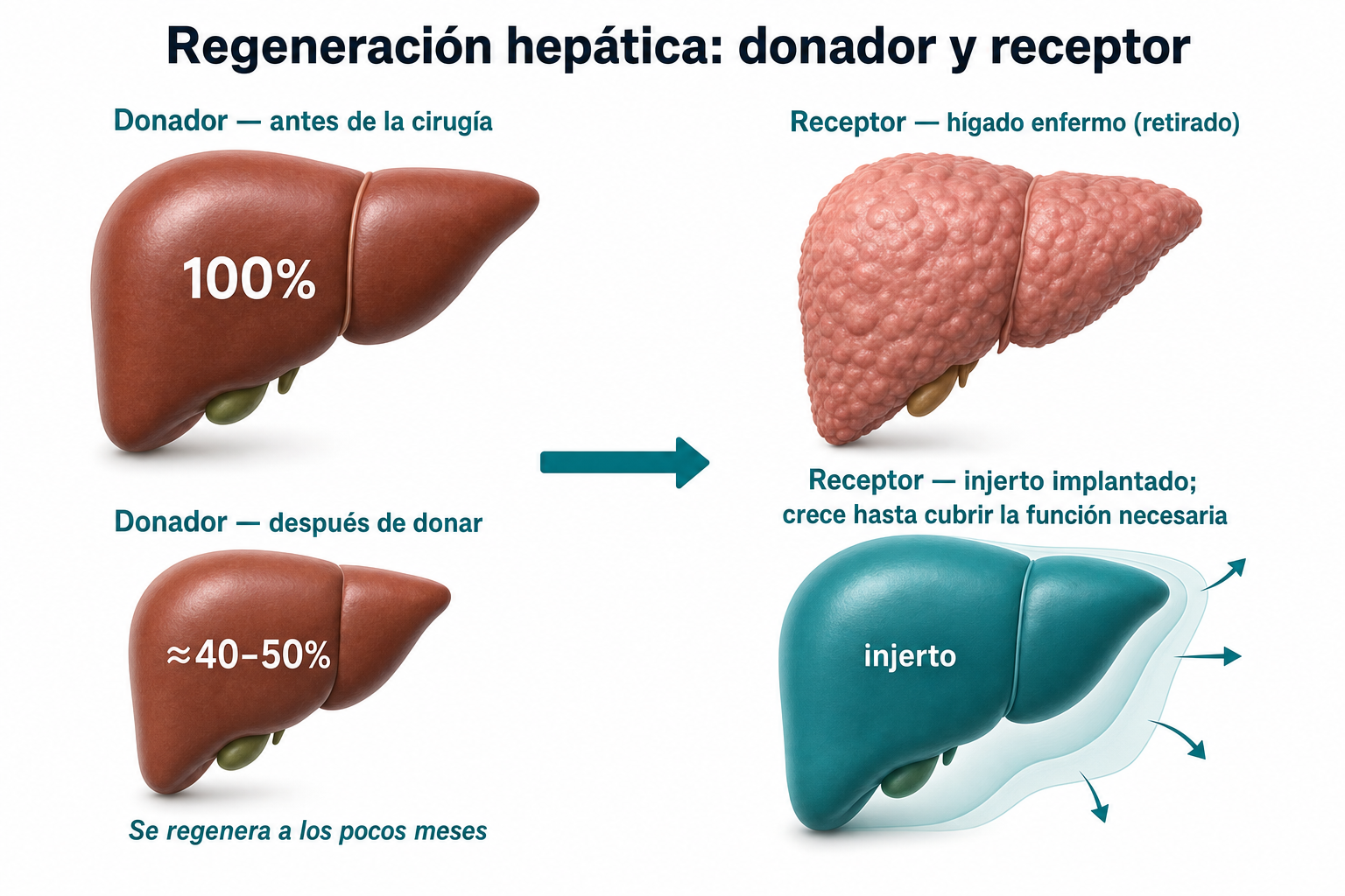 Infografía: regeneración hepática del donador y crecimiento del injerto en el receptor